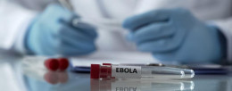 Why Ebola Virus Kills Too Fast